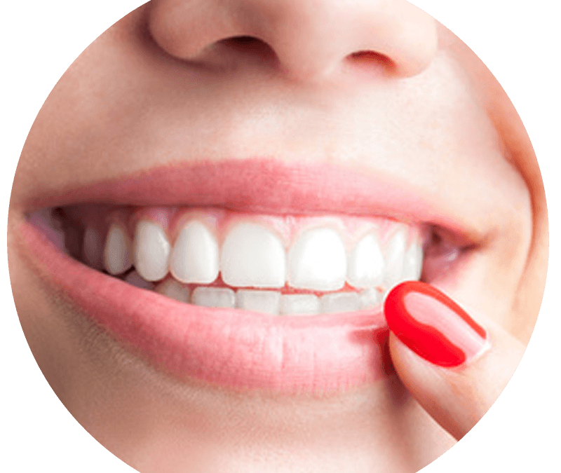  Illuminate Your Smile: Unveiling the Magic of Cochrane Teeth Whitening at Bow River Dental